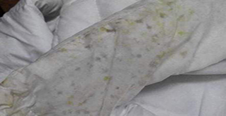 衣服發(fā)霉 衣服發(fā)霉