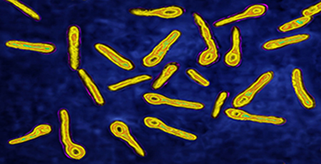 破傷風(fēng)桿菌 破傷風(fēng)桿菌